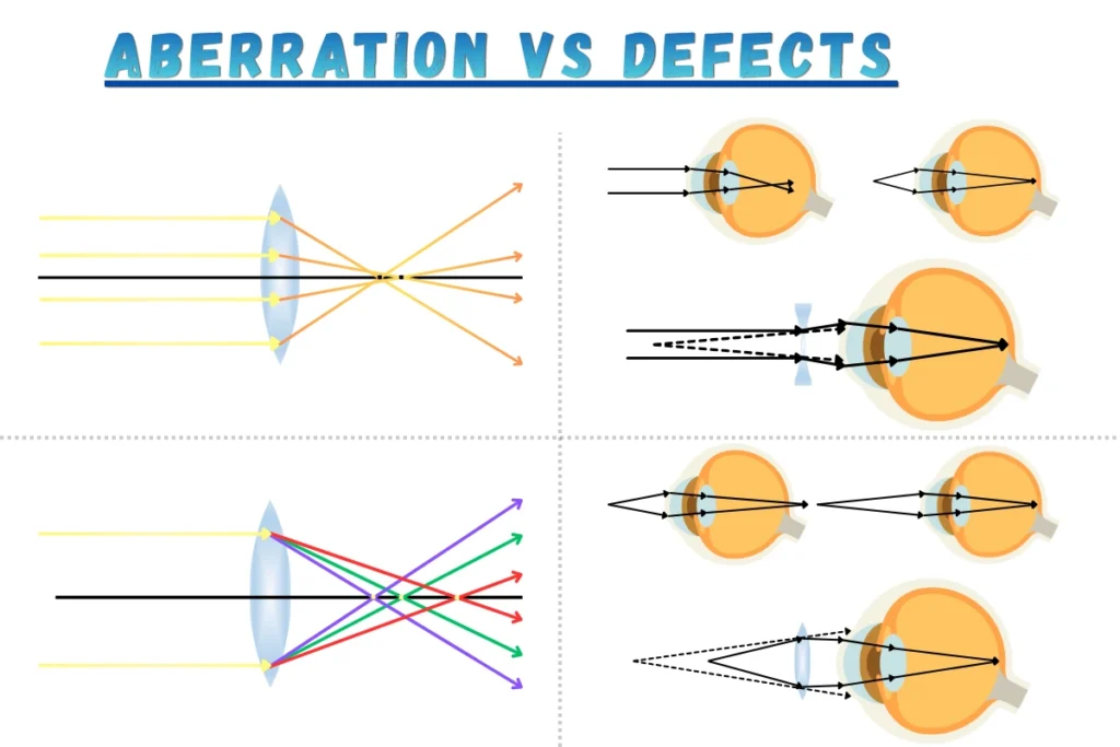 01 - Illustration _ Aberration of Lens vs Defect of Vision